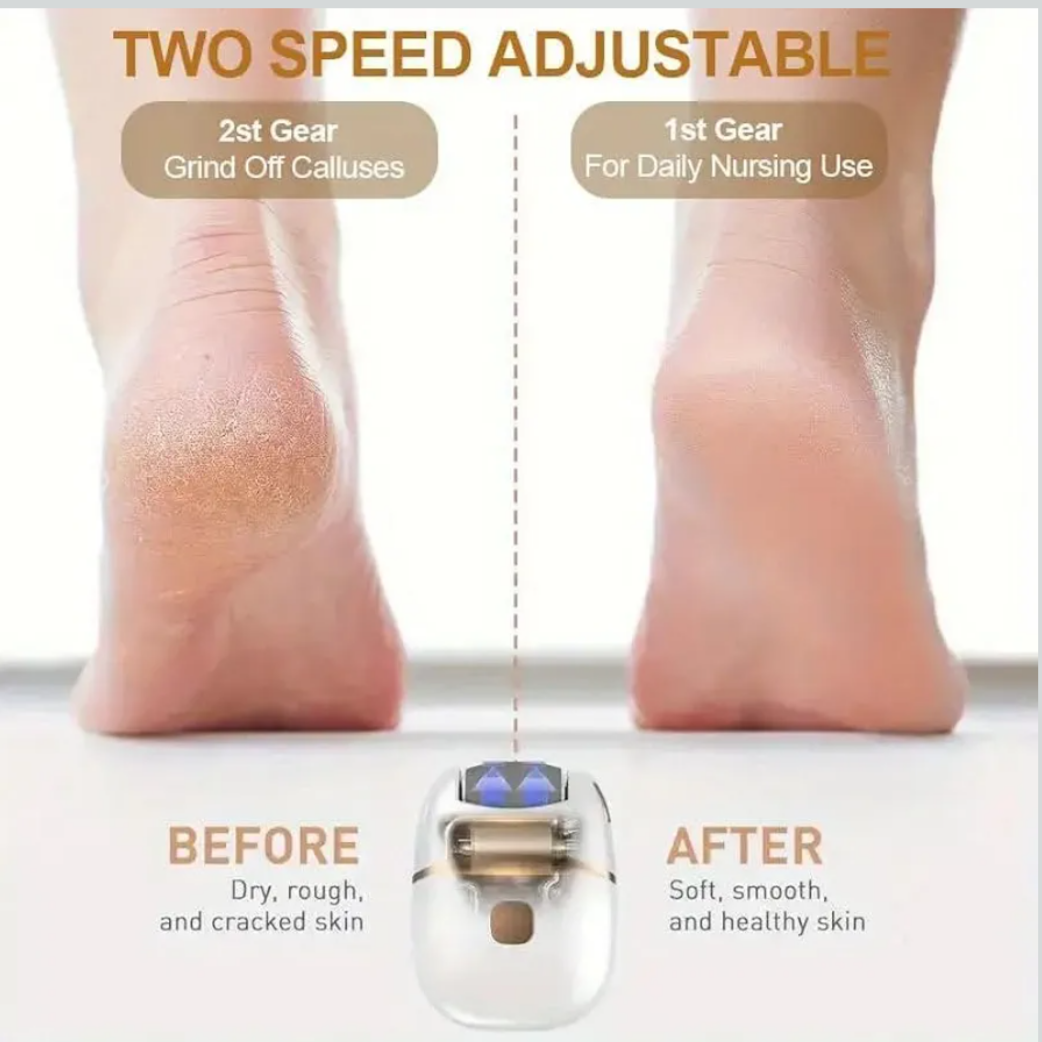 Electronic Pedicure Tool